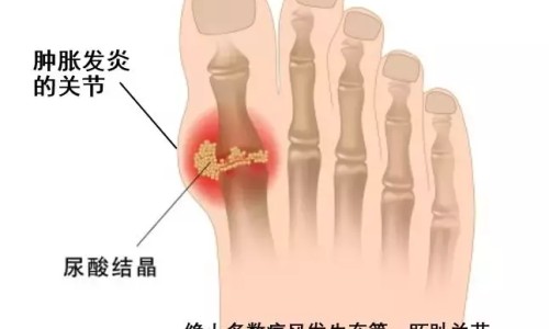 权威感冒惊厥是什么症状平台,分享专业导致小儿感冒夹惊的生理特点知识_感冒夹惊症状网